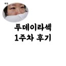 캠브리지5층약국 | 강남 밝은성모안과 투데이라섹 1주차 후기 #할인정보 #내돈내산