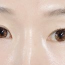 알프스안경위드렌즈 이미지