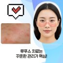 마산백내과의원 | 루푸스 임신 준비할 때 류마티스내과 관리가 중요한 이유