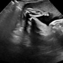 야탑로65번길 이미지