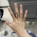 뉴덕산약국 | 예? 제가 정맥기형이라고요? 손가락혹 제거 수술 후기 썰푼다( 후기, 시간, 총 금액)