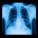 망포세우린한의원 이미지