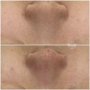 성내동 피부관리 천호 유나에스테틱에서 수분 꽉꽉 채우고 온 후기_성내동 에스테틱