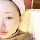 목동 | 피부리프팅 피코스컬프팅 추천 목동피부과 내돈내산 후기