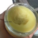 태열 / 영아습진 / 아토피 ?