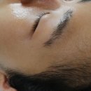 어나더뷰티스킨