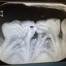 아이사랑치과의원 이미지