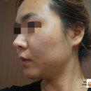 여드름피부좋아지는법으로 하는 여드름마스크팩 후기에요.