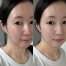 디어블루 | 디어 클레어스 블루 유스 액티베이팅 드롭 2개월 사용 후기｜올리브영 트러블 흔적 앰플 비교 (브링그린...