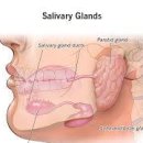 이하선 종양 증상 원인 수술 귀밑 침샘 멍울 이미지