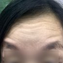 신세계성형외과의원 - 남구 삼산로267번길 6-10 | 청량리 보톡스 내돈내산후기 이마 미간 눈가 보톡스 코어톡스 하이톡스