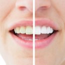 하얀치과 이미지