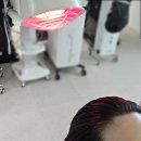 남양주두피관리 엠지에프두피탈모센터 얇아진 모발 탈모 집중관리 후기