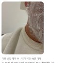 나의계절의원 | 나의계절의원 시술 후기, 칭찬 리뷰 III