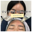 감성의원 | 얀의원 포텐자펌핑팁 + 쥬베룩 스킨부스터 2회차 솔직후기