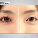 아이트렌드