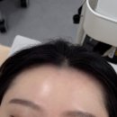 우리동네힐링샵 의정부1호점 | [의정부왁싱] 스튜디오 촬영 전 필수 코스! '글루아' 페이스 헤어라인 왁싱 찐 후기 ✨