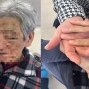 ﻿환자에 맞아 숨진 85살…“CCTV엔 요양보호사가 5분 먼저 폭행” 이미지