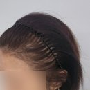 부평탈모관리 콤마더문 부평 헤어라인 대만족 후기