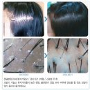 닥터베버힐 | 두피관리잘하는곳,탈모관리잘하는곳,탈모두피관리센터 베버힐