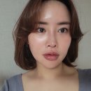 대구수성구피부과 리쥬엘 눈 밑 필러 후기