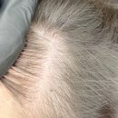 경안동 154-6 | 경안동두피커버ㅣ여성탈모 걱정없는 블랙톡톡