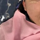 별내굿타임의원 | 남양주별내피부과 슈링크 리프팅 잘하는곳 효과 후기
