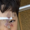 지니성형외과의원 | 대구 중구 닥터지니 성형외과 아이 봉합 수술 전문 강력 추천합니다. (25.6.27-28)