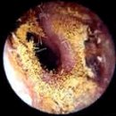 세종보청기 이미지