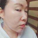 중국 한의원 | 포항 피부 한의원 실리프팅 매선 잘하는 곳 비포에프터 내돈내산 후기