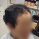 김호증모가발앤행복헤어샵 | 창원 정수리가발 쉽고 편해요~어버이날 선물 추천!