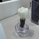 봉화산역 임플란트 전문 치과 잘하는 곳 추천 좋아요 6곳