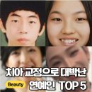 단아치과 | [심층분석] "성형인 줄 알았지?" 연예인 교정 전후의 진실... (feat. 저의 멘붕 상담 후기)