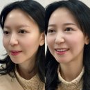 서울대입구눈썹 [ 블랙여우 왁싱&속눈썹 ] 눈썹 후기