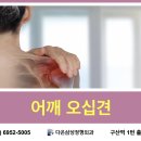 연신내정형외과의원 | [연신내정형외과]어깨 오십견의 도수치료는?