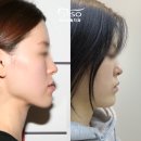 바른우리치과교정과치과의원 | 주걱턱 원인, 수술 없이도 개선되는 이유 (25년 차 치과원장의 고백)