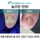 닥터페디거제장평점&독일식문제성발관리 | 거제 악성 발톱 관리, 이전한 닥터페디 거제고현점에서 편안하게