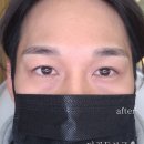 골든브로우 네이버블로그