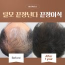 글로웰의원 이미지