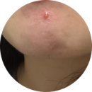 아주인센티브주 | 위고비 나눠맞기 6회차 내돈내산 후기! 마운자로 갈아타기 후 효과 및 비교(2.4mg 나눠맞기 팁)