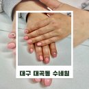 네일 수 | 대구 달서구 내성발톱 케어 네일샵 수네일 네일관리 후기 발관리 잘하는 곳