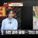 수영장서 입수하다 전신마비 이미지