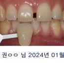 선치과기공소 이미지