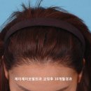 제이제이서연외과의원 네이버블로그