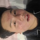 메디비바
