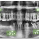 은천동-17 이미지