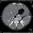H플란트치과의원 이미지
