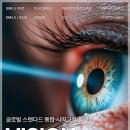 스마일 | 스마일라식후기 많이 읽을수록 헷갈렸던 이유를 정리했어요