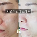 자연미인 에스테틱 이미지