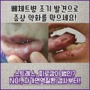 장기성모내과의원 | 서울 영등포 다치지 않았는데 관절이 아플 때 류마내과 의원
